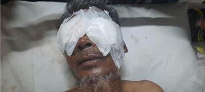 গচ্ছিত টাকা-স্বর্ণ ফেরত চাওয়ায় ভাইয়ের চোখ তুলে নিল দুই ভাই
