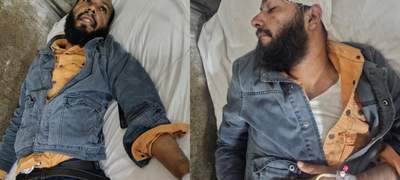বরিশালে সাংবাদিককে হাতুড়িপেটা করলেন পুলিশ কনস্টেবল