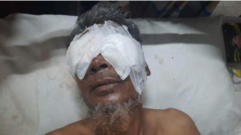 গচ্ছিত টাকা-স্বর্ণ ফেরত চাওয়ায় ভাইয়ের চোখ তুলে নিল দুই ভাই